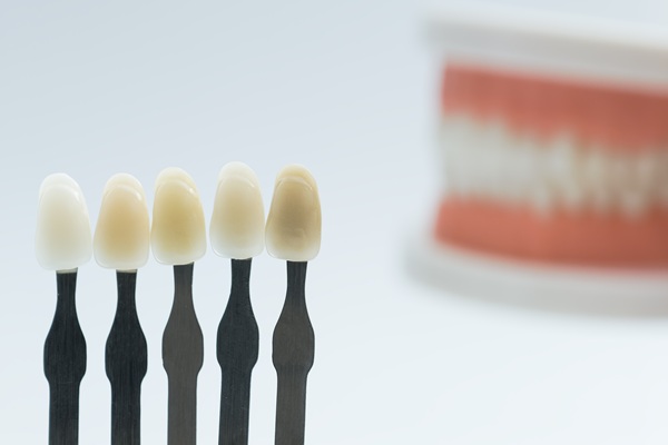 Signs A Patient May Benefit From Dental Bonding