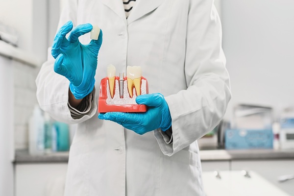 Reasons To Consider Same Day Crowns To Restore Your Smile
